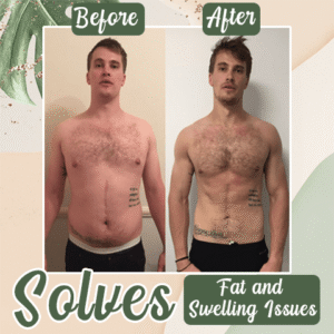 Perfect Detox Slimming Patch(Limited Time Discount 🔥 Last Day) - Emporium Shop